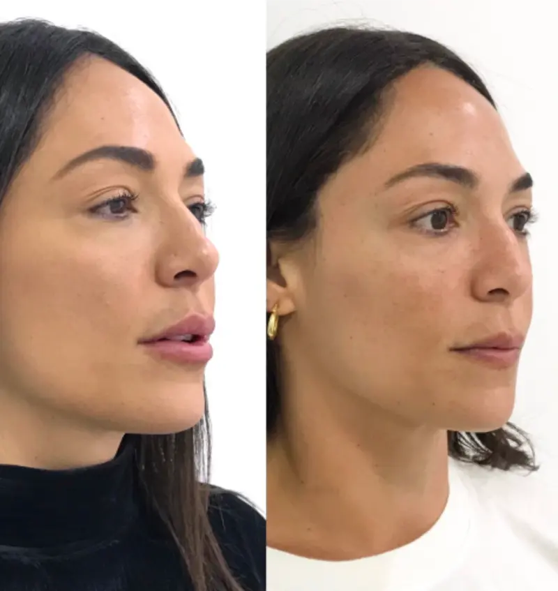 Antes e depois — caso 01