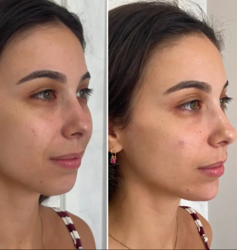 Antes e depois — caso 02