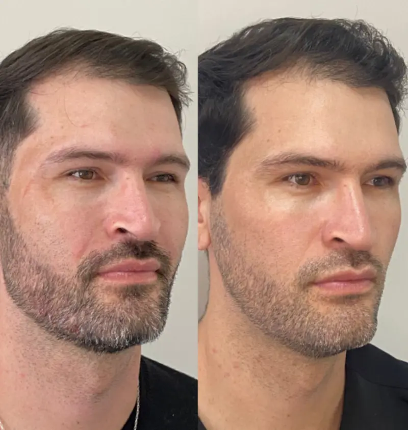 Antes e depois — caso 05